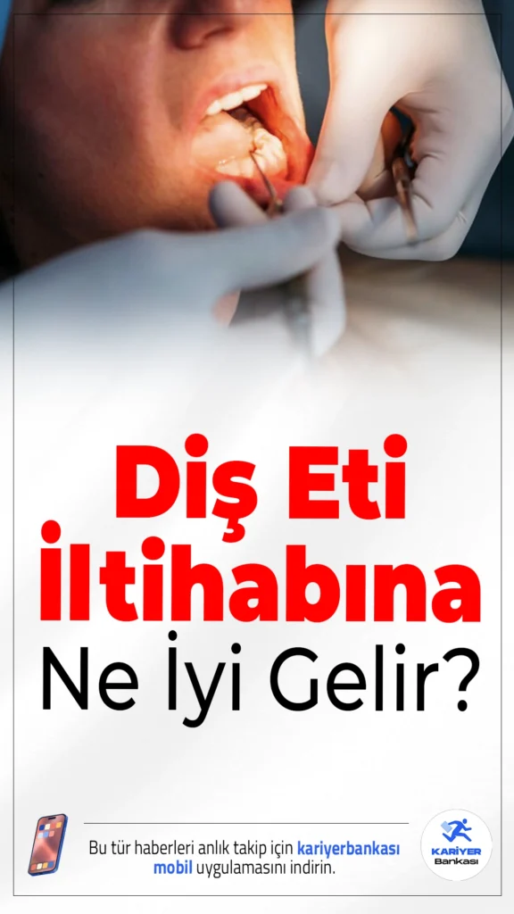 Diş Eti İltihabına Ne İyi Gelir? Nasıl Geçer?Diş eti kanaması ve ağrı hafife alınmamalı; erken müdahale ile diş eti iltihabı kolayca kontrol altına alınabilir.