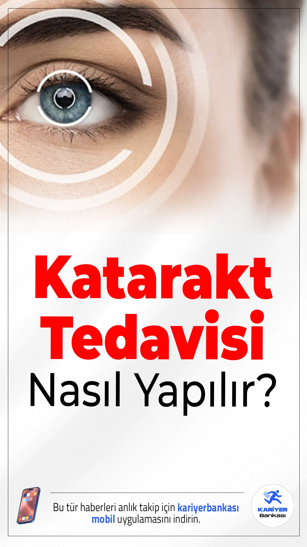 Katarakt Tedavisi Artık Çok Kolay: Buzlu Görmeye Son Veren Yöntemler.Katarakt, günümüzde kısa süren modern ameliyatlarla tedavi edilebiliyor; doğru yöntemle hastalar net görüşe yeniden kavuşuyor.