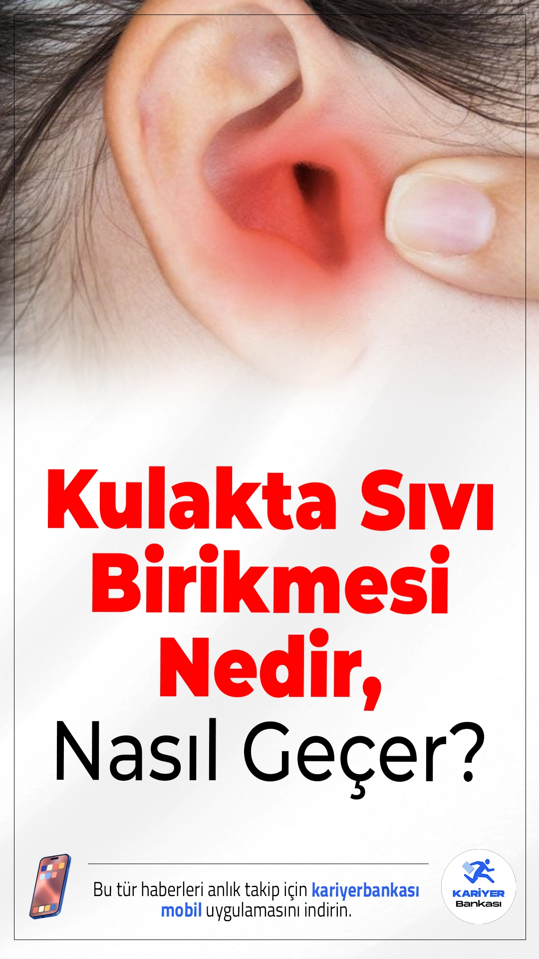 Kulakta Sıvı Birikmesi Nedir, Nasıl Geçer? Çocuklarda Bu Belirtilere Dikkat.Kulakta sıvı birikmesi özellikle çocuklarda sinsi ilerleyebilir; işitme kaybı ve gelişim sorunlarına yol açabilir.
