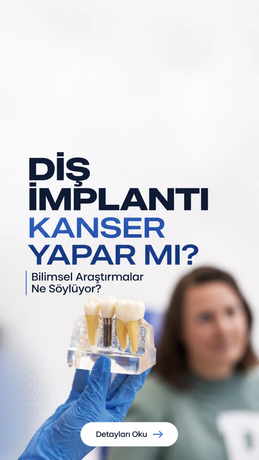 Diş İmplantı Kanser Yapar mı? Bilimsel Araştırmalar Ne Söylüyor?Diş implantı kanser yapar mı sorusu merak ediliyor. Bilimsel veriler implantların güvenli olduğuna işaret ediyor.